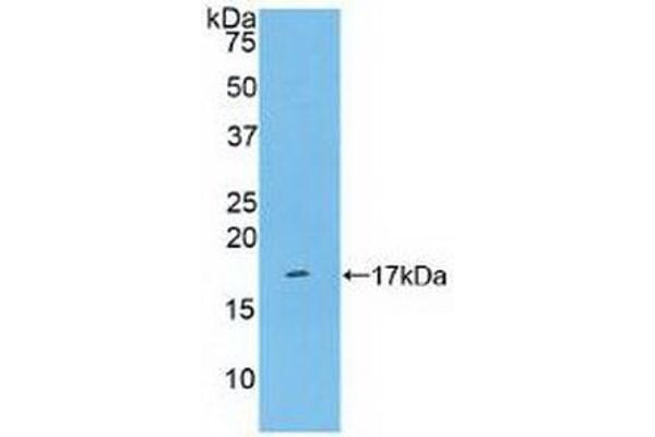CD161 抗体  (AA 73-188)