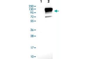 Western blot analysis of Lane 1: Negative control (vector only transfected HEK293T lysate) Lane 2: Over-expression lysate (Co-expressed with a C-terminal myc-DDK tag (~3. (Neuroligin 3 Antikörper)
