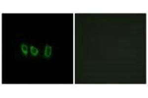 Immunofluorescence analysis of A549 cells, using CSTL1 antibody. (CSTL1 Antikörper)
