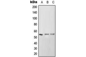 Western blot analysis of CD102 expression in HeLa (A), SP2/0 (B), PC12 (C) whole cell lysates. (ICAM2 Antikörper  (Center))