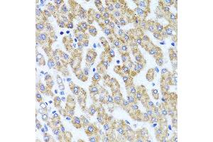 Immunohistochemistry of paraffin-embedded human liver injury using INADL antibody at dilution of 1:100 (x40 lens).