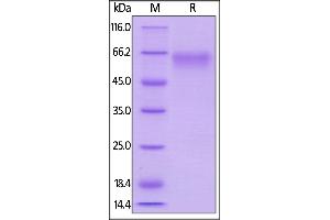 SDS-PAGE (SDS) image for CD27 Molecule (CD27) (AA 21-182) (Active) protein (Fc Tag) (ABIN5955007)