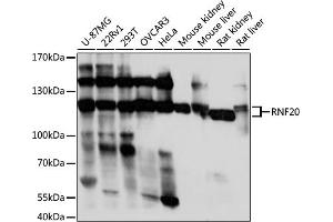 Western blot analysis of extracts of various cell lines, using RNF20 antibody (ABIN7270072) at 1:1000 dilution.