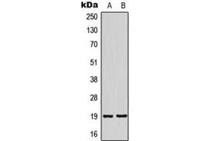 Western blot analysis of NSG2 expression in SHSY5Y (A), HeLa (B) whole cell lysates. (NSG2 Antikörper  (Center))