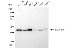anti-SEC14-Like 2 (SEC14L2) antibody