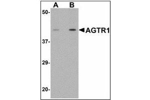 Western blot analysis of AGTR1 in mouse kidney tissue lysate with AGTR1 antibody at (A) 1 and (B) 2 µg/ml. (Angiotensin II Type-1 Receptor Antikörper)