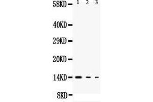 Anti-IL3 antibody, Western blotting All lanes: Anti IL3  at 0. (IL-3 Antikörper  (Middle Region))