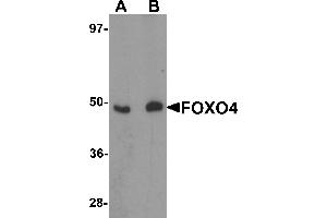 Western Blotting (WB) image for anti-Forkhead Box O4 (FOXO4) (N-Term) antibody (ABIN1031385) (FOXO4 Antikörper  (N-Term))