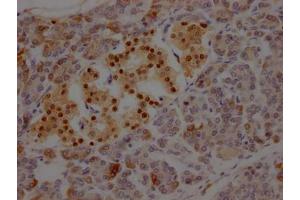 IHC image of ABIN7127582 diluted at 1:100 and staining in paraffin-embedded human pancreatic tissue performed on a Leica BondTM system. (Rekombinanter ISL1 Antikörper)