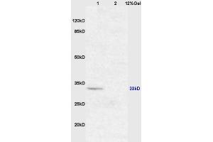 Lane 1: mouse brain lysates Lane 2: mouse intestine lysates probed with Anti XAF1/FBXO39 Polyclonal Antibody, Unconjugated (ABIN674754) at 1:200 in 4 °C. (XAF1 Antikörper  (AA 151-250))