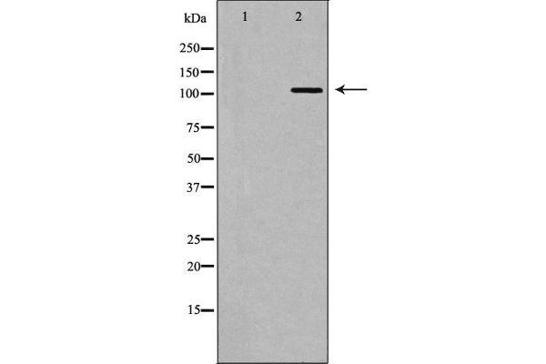 IFIH1 antibody  (C-Term)
