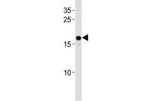 HMGA2 antibody western blot analysis in HepG2 lysate. (HMGA2 Antikörper  (AA 64-92))