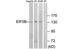 Western blot analysis of extracts from Jurkat/HepG2/A549 cells, using EIF5B Antibody. (EIF5B Antikörper  (AA 1051-1100))