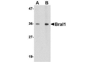 Western blot analysis of BRAL1 in human brain tissue lysate with BRAL1 antibody at (A) 1 and (B) 2 μg/ml. (HAPLN2 Antikörper  (Center))