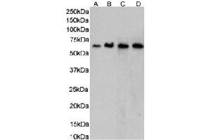 Western Blot using anti-CCR5 (PKC site) antibody RC-10.