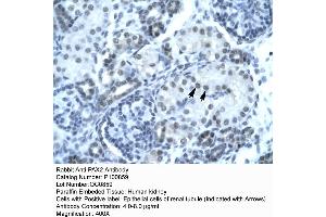 Rabbit Anti-PAX2 Antibody  p100859 Paraffin Embedded Tissue: Human Kidney Cellular Data: Epithelial cells of renal tubule Antibody Concentration: 4. (PAX2A Antikörper  (Middle Region))