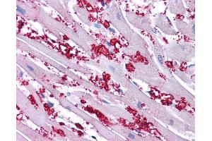 KCNA10 antibody was used for immunohistochemistry at a concentration of 4-8 ug/ml.