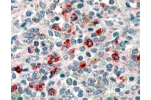 Image no. 1 for anti-CD14 (CD14) (Internal Region) antibody (ABIN374645) (CD14 Antikörper  (Internal Region))