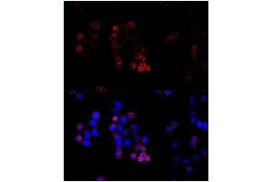 Immunofluorescence (IF) image for anti-ATP-Binding Cassette, Sub-Family G (WHITE), Member 8 (ABCG8) (AA 1-320) antibody (ABIN6219013) (ABCG8 Antikörper  (AA 1-320))