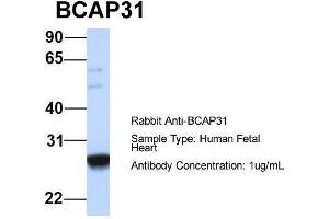 Host:  Rabbit  Target Name:  BCAP31  Sample Type:  Human Fetal Heart  Antibody Dilution:  1. (BCAP31 Antikörper  (Middle Region))