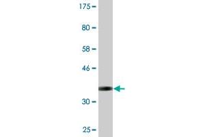 Western Blot detection against Immunogen (37. (Syndetin/VPS50 Antikörper  (AA 862-964))
