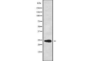 Western blot analysis of RPL13A using COS7 whole cell lysates