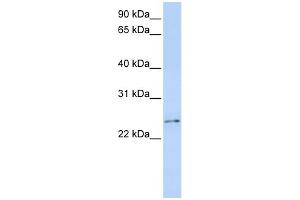 WB Suggested Anti-RCAN3 Antibody Titration:  0. (RCAN3 Antikörper  (Middle Region))