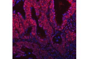 IF analysis of SNRNP200 using anti-SNRNP200 antibody (ABIN7602032). (SNRNP200 Antikörper  (AA 557-2129))