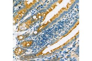 Immunohistochemistry (Paraffin-embedded Sections) (IHC (p)) image for anti-Microtubule-Associated Protein 7 (MAP7) antibody (ABIN7074621)