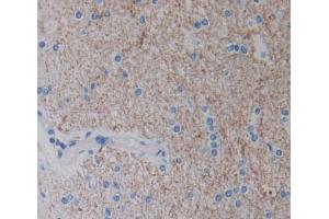 IHC-P analysis of brain tissue, with DAB staining. (EPH Receptor A4 Antikörper  (AA 621-882))