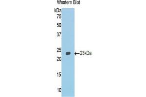 Western Blotting (WB) image for anti-Cadherin 1, Type 1, E-Cadherin (Epithelial) (CDH1) (AA 751-884) antibody (ABIN7437818)