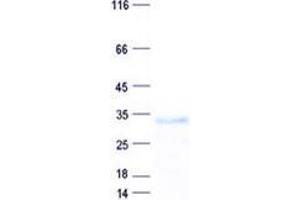 Western Blotting (WB) image for DDHD Domain Containing 2 (DDHD2) protein (His tag) (ABIN5505613)