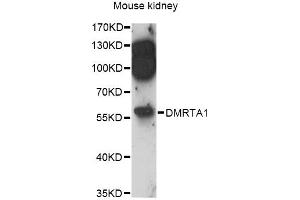 Western blot analysis of extracts of mouse kidney, using DMRTA1 antibody (ABIN6292013) at 1:3000 dilution. (DMRTA1 Antikörper)