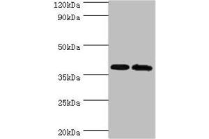 Western blot All lanes: PBK antibody at 6 μg/mL Lane 1: Hela whole cell lysate Lane 2: Mouse gonad tissue Secondary Goat polyclonal to rabbit IgG at 1/10000 dilution Predicted band size: 37, 38 kDa Observed band size: 37 kDa (PBK Antikörper  (AA 1-322))