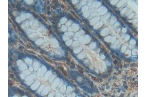 Detection of PDGF BB in Human Rectum Tissue using Polyclonal Antibody to Platelet Derived Growth Factor BB (PDGF BB) (PDGF-BB Homodimer (AA 82-190) Antikörper)