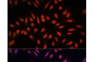 Immunofluorescence analysis of U-2 OS cells using KLHL8 Polyclonal Antibody at dilution of 1:100. (KLHL8 Antikörper)