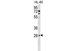 Western Blotting (WB) image for anti-Ras Homolog Gene Family, Member B (RHOB) (AA 103-137), (Middle Region) antibody (ABIN954540)