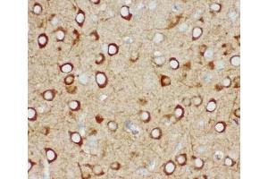 Immunohistochemistry (IHC) image for anti-Inositol 1,4,5-Trisphosphate Receptor, Type 3 (ITPR3) (AA 2411-2758) antibody (ABIN3031328)