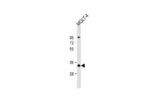 Anti-ZWINT Antibody (Center) at 1:1000 dilution + MOLT-4 whole cell lysate Lysates/proteins at 20 μg per lane. (ZWINT Antikörper  (AA 59-88))