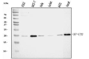 Western blot analysis of MT-CO2 using anti-MT-CO2 antibody (ABIN7599081). (COX2 Antikörper  (AA 1-205))