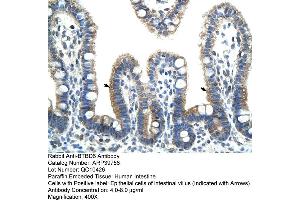 Human Intestine (BTBD6 Antikörper  (N-Term))