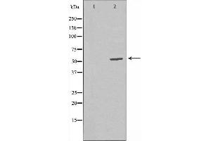 Western blot analysis of extracts from CoLo cells, using RBBP5 antibody. (RBBP5 Antikörper  (Internal Region))
