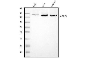 Western blot analysis of ATP7B using anti-ATP7B antibody (ABIN7600864).
