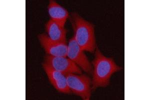 IF analysis of ST13 using anti-ST13 antibody (ABIN7600493). (HSC70 Interacting Protein HIP Antikörper  (AA 2-369))