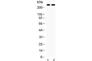 Western blot testing of 1) rat eye and 2) mouse eye lysate with ABCA4 antibody at 0.