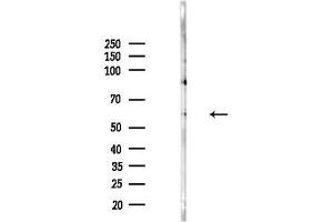 Western blot analysis of lysates from Hela cells(heat-shock,45 min treatment), using C/CEACAM1 Antibody at 1/1000 dilution.