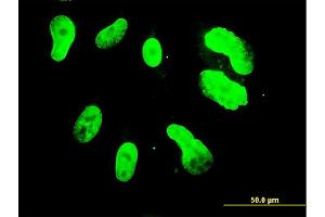 Immunofluorescence of monoclonal antibody to TBX3 on HepG2 cell. (TBX3 Antikörper  (AA 311-410))