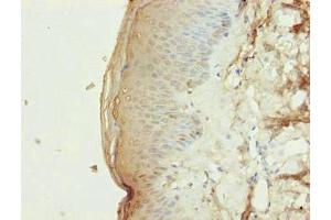 Immunohistochemistry of paraffin-embedded human skin tissue using ABIN7163341 at dilution of 1:100