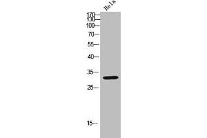 Western blot analysis of Hela lysate, antibody was diluted at 2000. (CDK6 Antikörper  (AA 280-325))