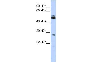 WB Suggested Anti-RNF212 Antibody Titration:  0. (RNF212 Antikörper  (Middle Region))
